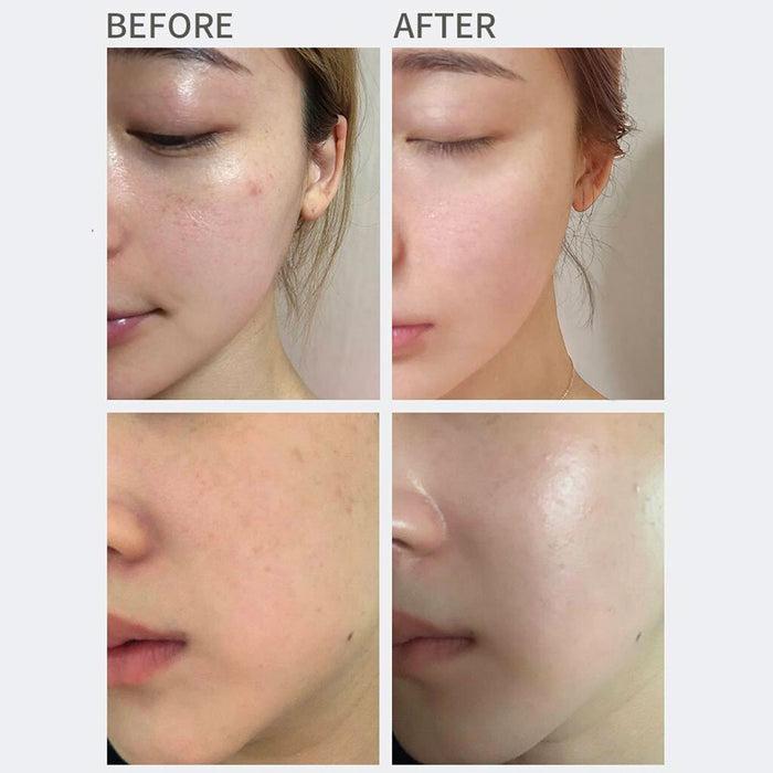 Heimish All Clean Vitamin Blemish Spot Clear Cream Review Nudie Glow Australia