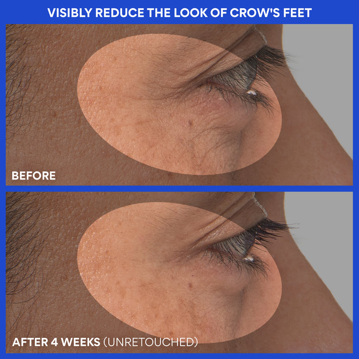 Retinol Green Tea PDRN™ Firming Serum before and after 4 weeks: visibly reduce the look of crow's feet