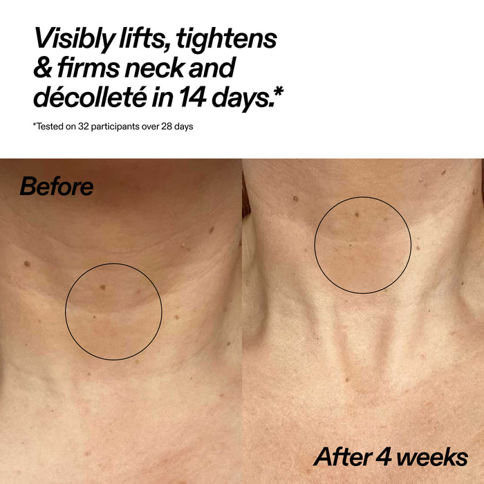 Bio-Active Ceramide Neck Stick
