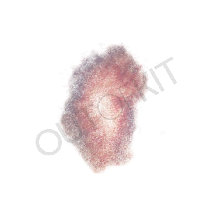 Bruise 4