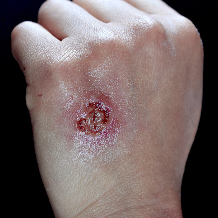 Cigarette Burn 2