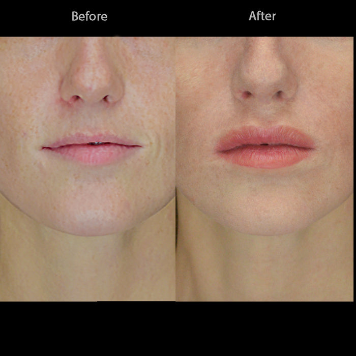 Female Character Lips