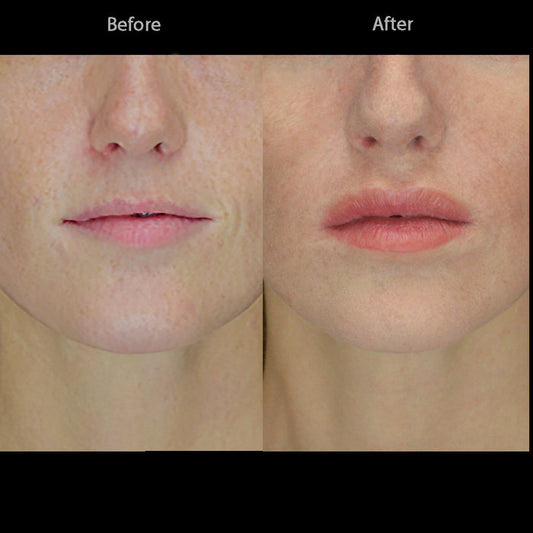Female Character Lips