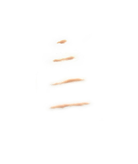 Forearm Scar