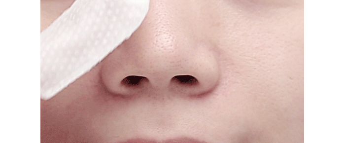 A'PIEU Goblin Blackhead Peeling Pad Nudie Glow Australia