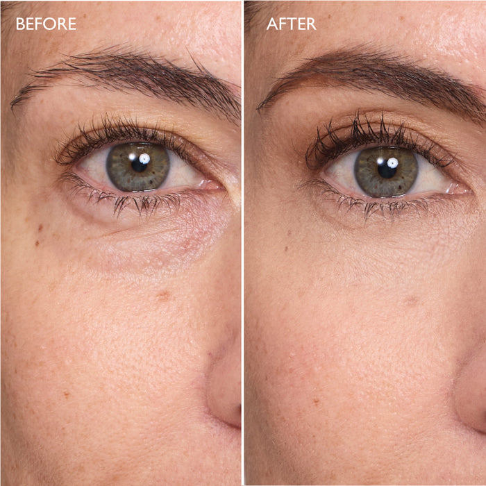 Miracle Eye Contour Cream