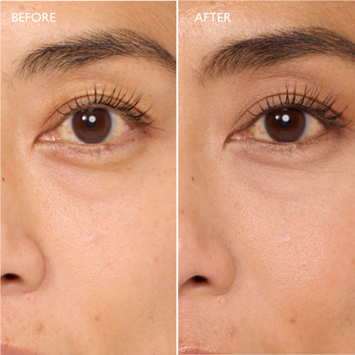 Miracle Eye Contour Cream