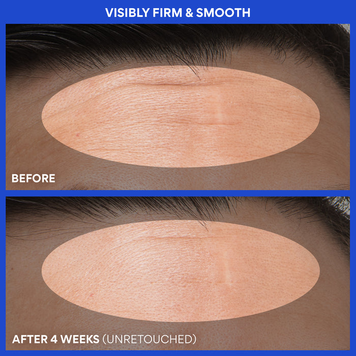 Retinol Green Tea PDRN™ Firming Serum before and after 4 weeks: visibly firm & smooth skin
