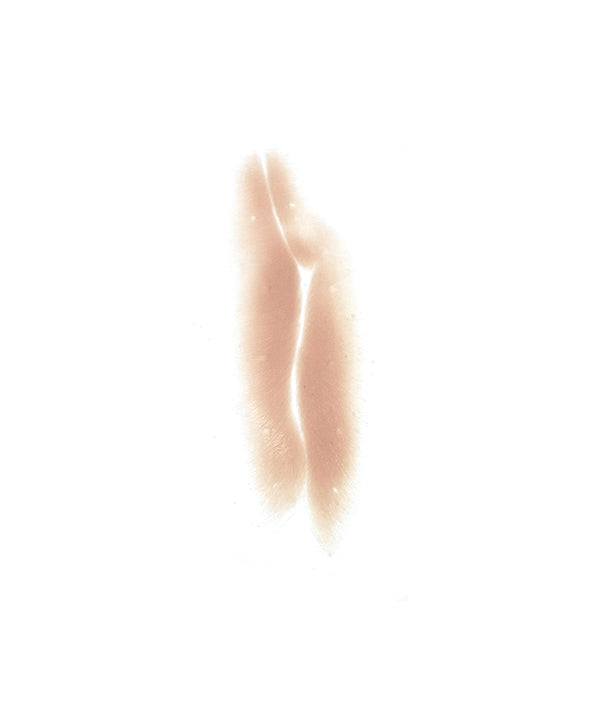 Shrapnel Scar 3