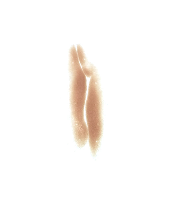 Shrapnel Scar 3