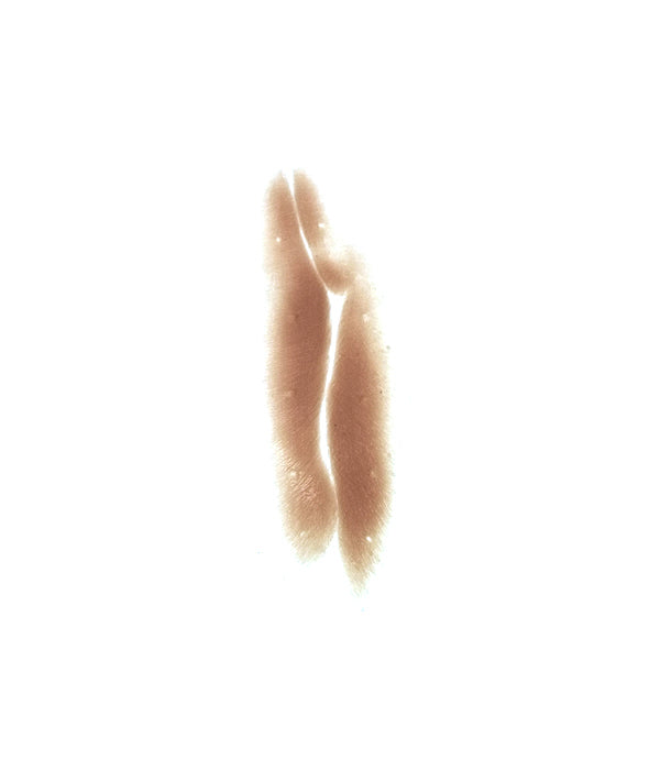 Shrapnel Scar 3