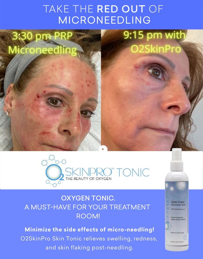 Skin Tonic