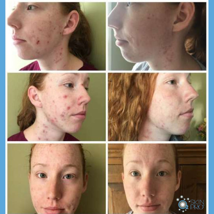 Skin Tonic
