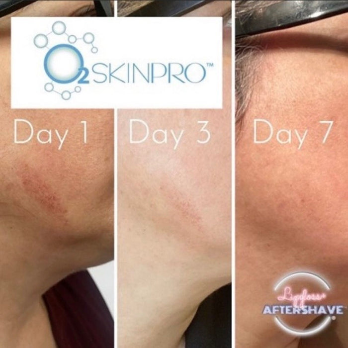 Skin Tonic