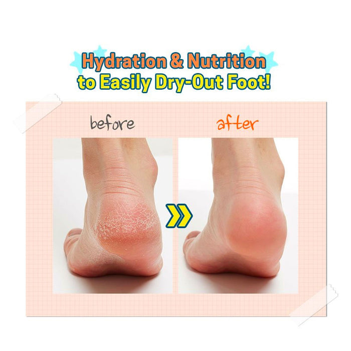 A'Pieu Soft Foot 30 Minute Peeling Socks Nudie Glow Australia