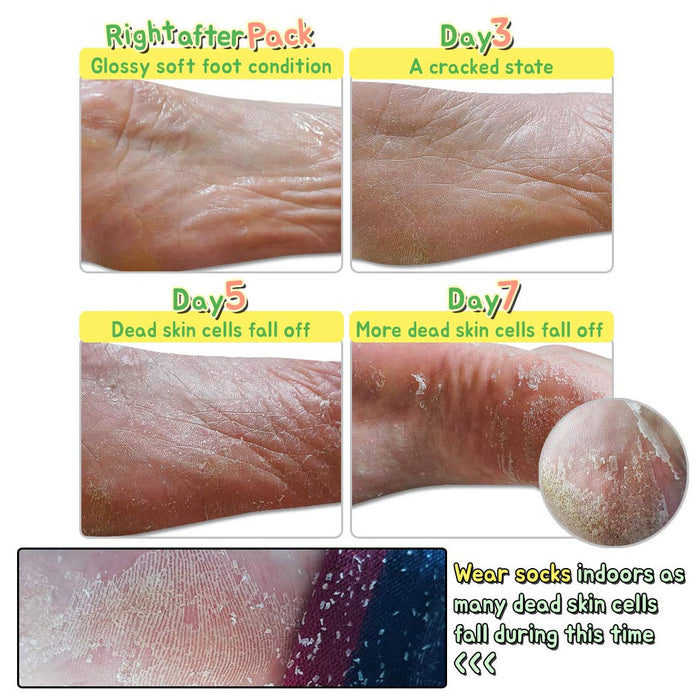 Elizavecca Witch Piggy Hell-Pore Turtle Foot Pack Nudie Glow Australia